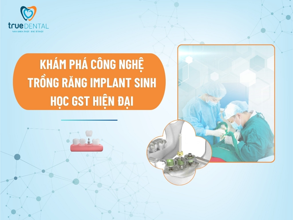 KHÁM PHÁ CÔNG NGHỆ TRỒNG RĂNG IMPLANT SINH HỌC GST HIỆN ĐẠI