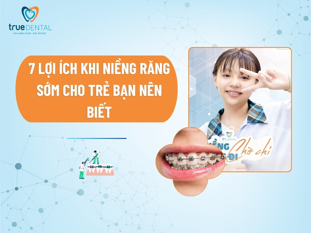 7 LỢI ÍCH KHI NIỀNG RĂNG SỚM CHO TRẺ BẠN NÊN BIẾT 7 7 LỢI ÍCH KHI NIỀNG RĂNG SỚM CHO TRẺ BẠN NÊN BIẾT