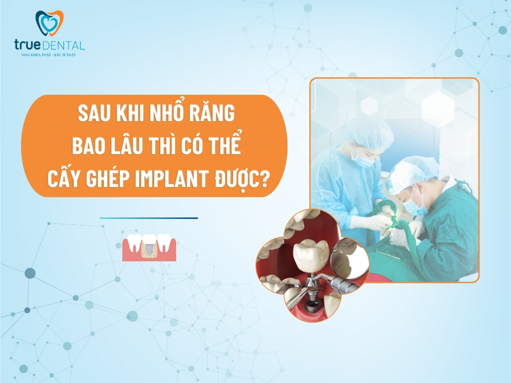 SAU KHI NHỔ RĂNG BAO LÂU THÌ CÓ THỂ CẤY GHÉP IMPLANT ĐƯỢC?