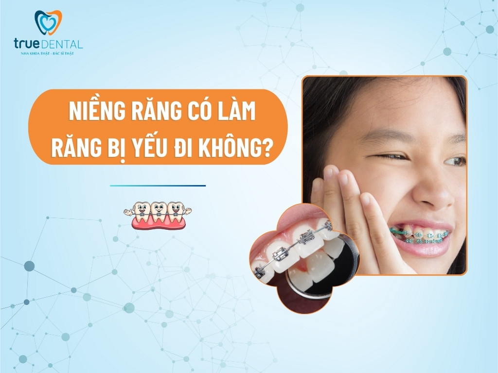 [GIẢI ĐÁP] NIỀNG RĂNG CÓ LÀM RĂNG BỊ YẾU ĐI KHÔNG?