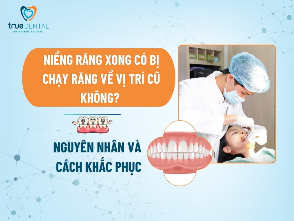 NIỀNG RĂNG XONG CÓ BỊ CHẠY RĂNG VỀ VỊ TRÍ CŨ KHÔNG? NGUYÊN NHÂN VÀ CÁCH KHẮC PHỤC 3 NIỀNG RĂNG XONG CÓ BỊ CHẠY RĂNG VỀ VỊ TRÍ CŨ KHÔNG? NGUYÊN NHÂN VÀ CÁCH KHẮC PHỤC