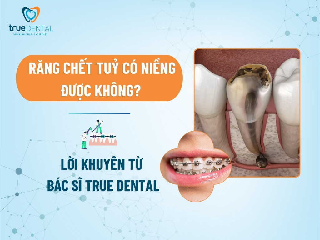 RĂNG CHẾT TUỶ CÓ NIỀNG ĐƯỢC KHÔNG? LỜI KHUYÊN TỪ BÁC SĨ TRUE DENTAL