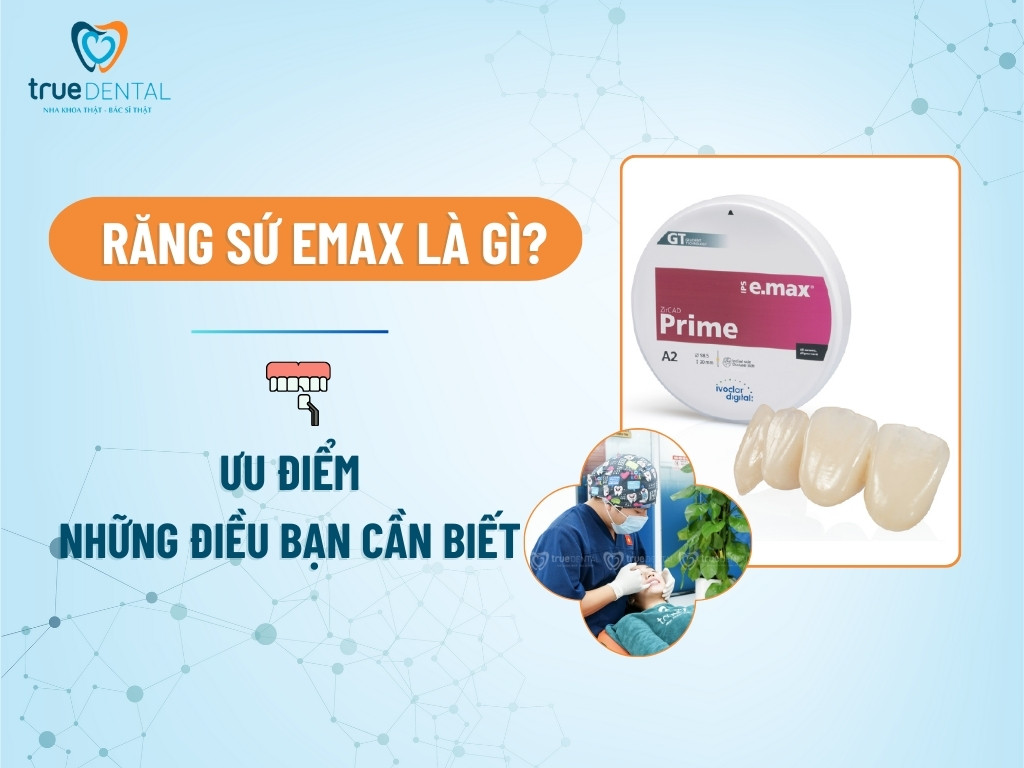 RĂNG SỨ EMAX LÀ GÌ? ƯU ĐIỂM VÀ NHỮNG ĐIỀU BẠN CẦN BIẾT