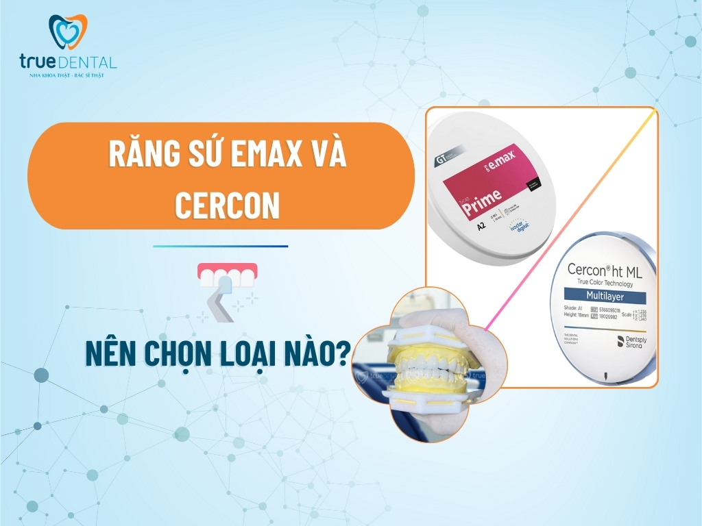 RĂNG SỨ EMAX VÀ CERCON: NÊN CHỌN LOẠI NÀO?
