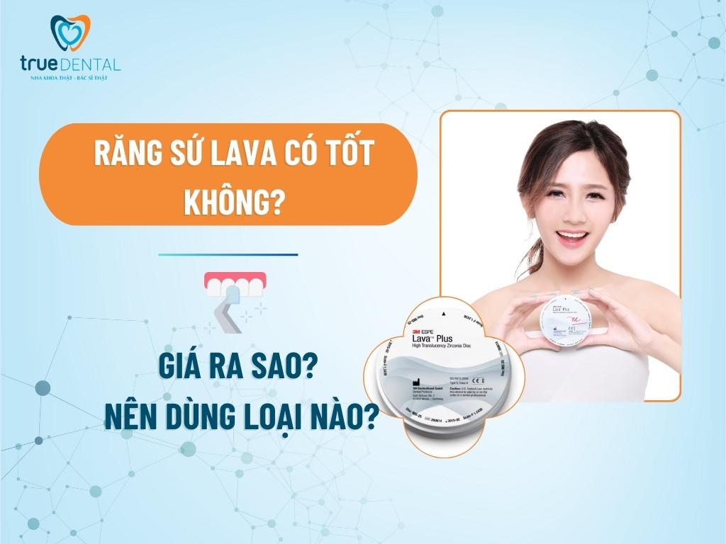 RĂNG SỨ LAVA CÓ TỐT KHÔNG? GIÁ RA SAO? NÊN DÙNG LOẠI NÀO?
