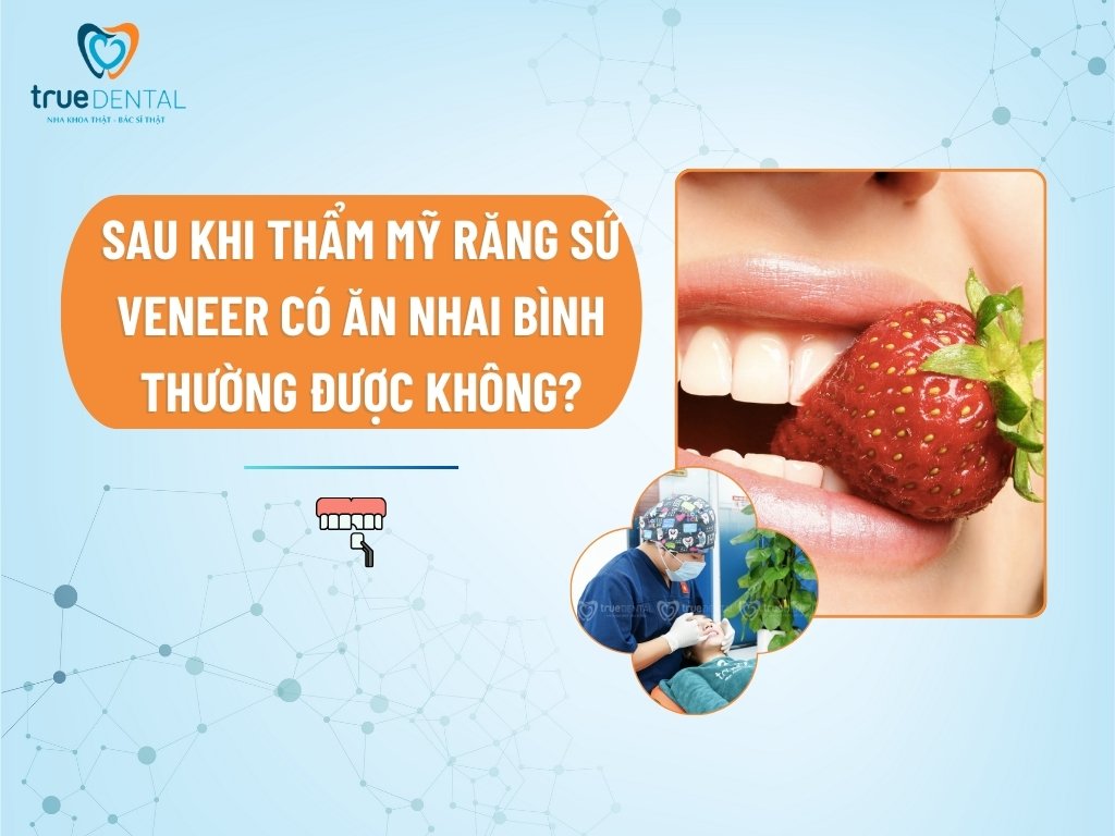SAU KHI THẨM MỸ RĂNG SỨ VENEER CÓ ĂN NHAI BÌNH THƯỜNG ĐƯỢC KHÔNG?