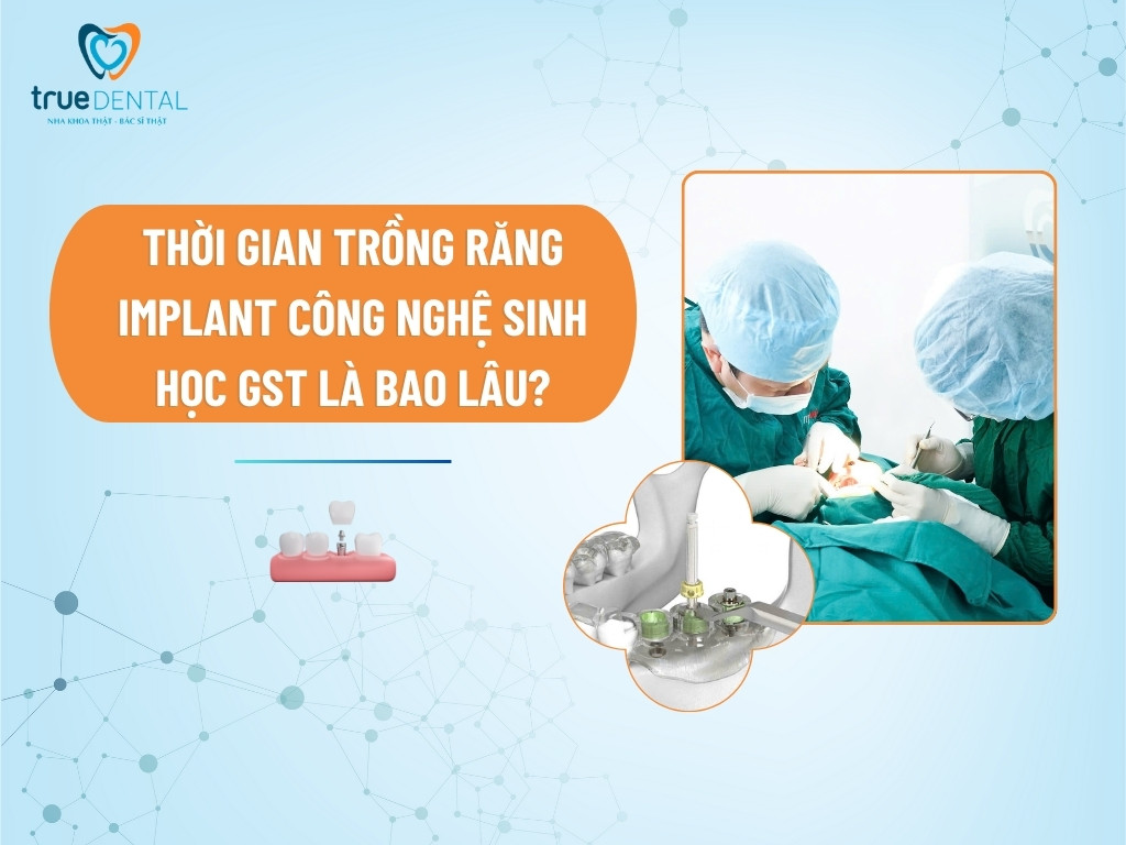 Thời gian trồng răng Implant công nghệ sinh học GST là bao lâu?