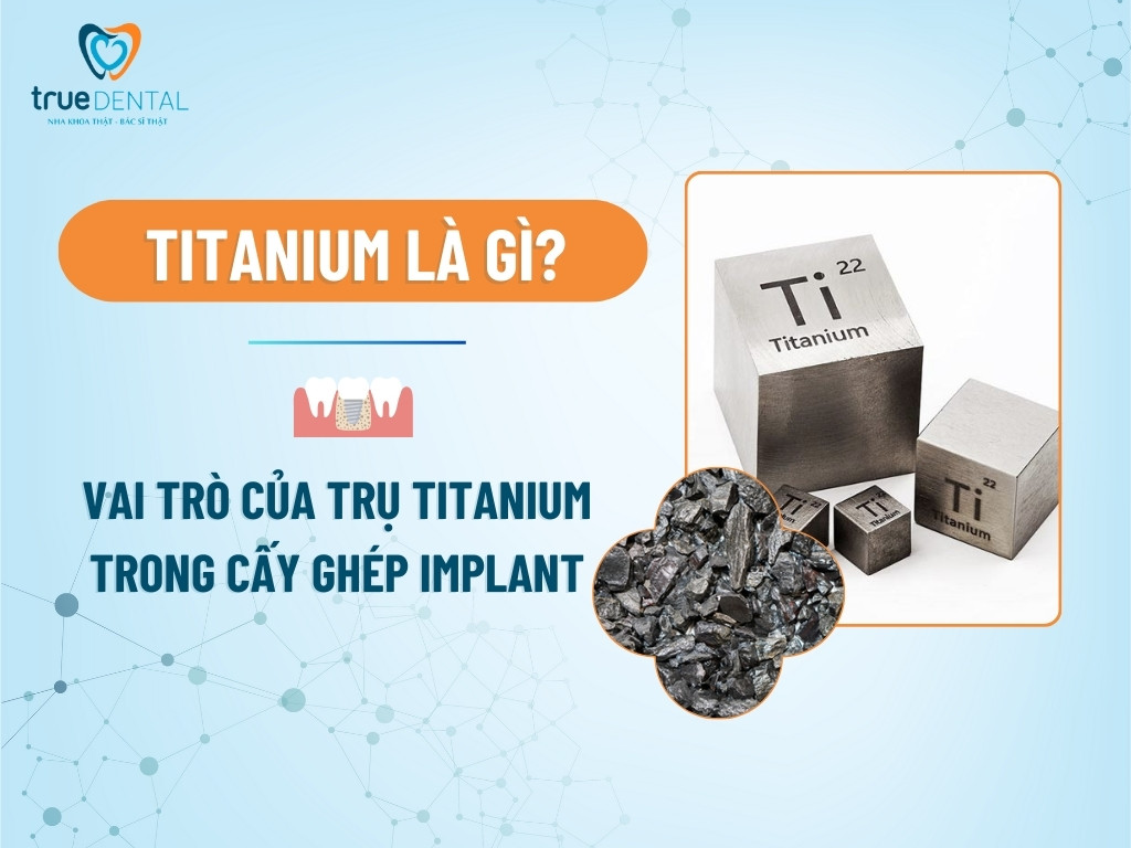TITANIUM LÀ GÌ? VAI TRÒ CỦA TRỤ TITANIUM TRONG CẤY GHÉP IMPLANT