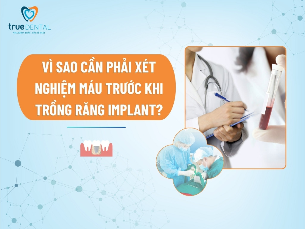[GIẢI ĐÁP] VÌ SAO CẦN PHẢI XÉT NGHIỆM MÁU TRƯỚC KHI TRỒNG RĂNG IMPLANT?