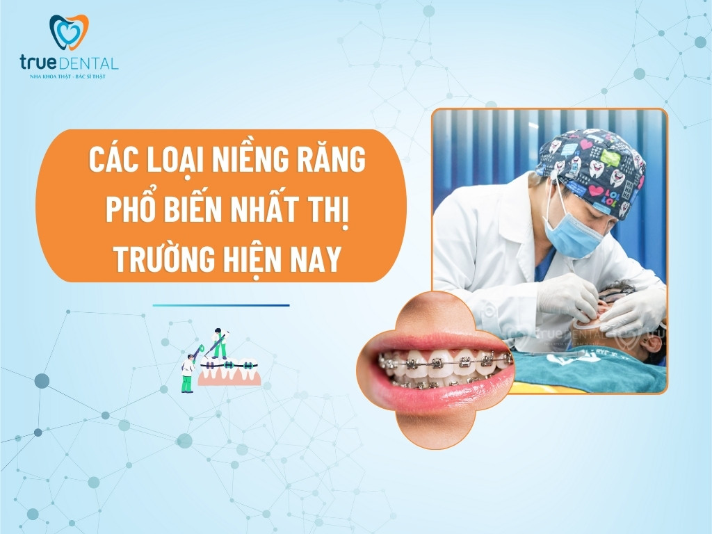 CÁC LOẠI NIỀNG RĂNG PHỔ BIẾN NHẤT THỊ TRƯỜNG HIỆN NAY