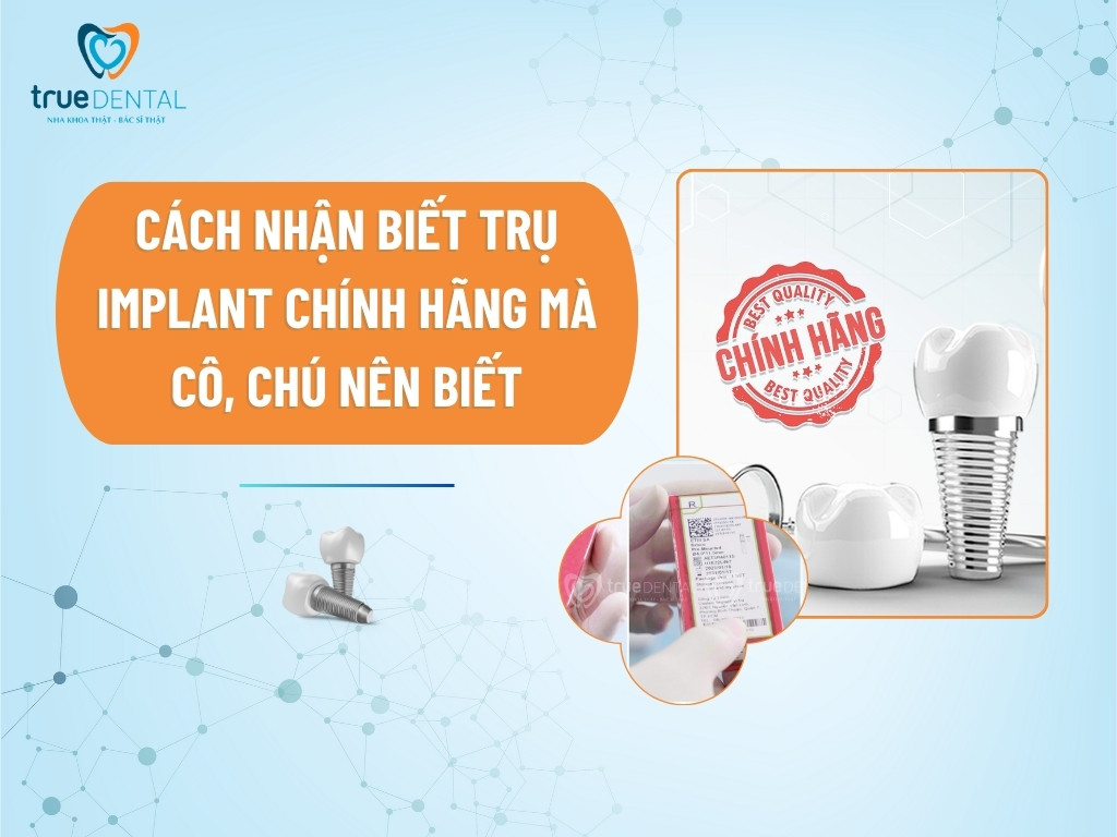 CÁCH NHẬN BIẾT TRỤ IMPLANT CHÍNH HÃNG MÀ CÔ, CHÚ NÊN BIẾT