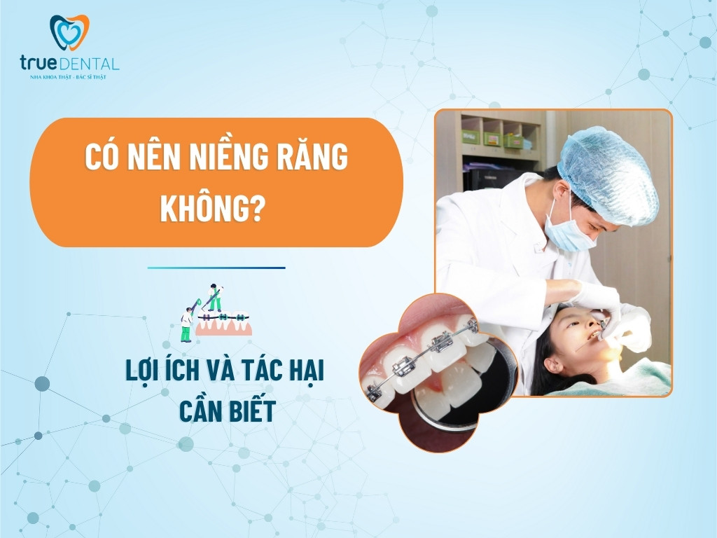CÓ NÊN NIỀNG RĂNG KHÔNG? LỢI ÍCH VÀ TÁC HẠI CẦN BIẾT 1 CÓ NÊN NIỀNG RĂNG KHÔNG? LỢI ÍCH VÀ TÁC HẠI CẦN BIẾT
