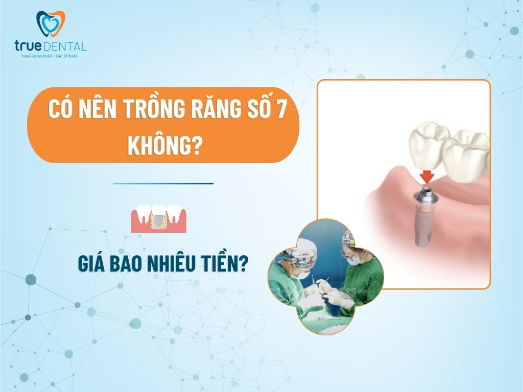 [GIẢI ĐÁP] CÓ NÊN TRỒNG RĂNG SỐ 7 KHÔNG? GIÁ BAO NHIÊU TIỀN?