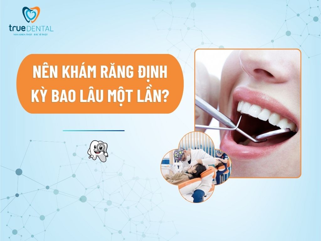[GIẢI ĐÁP] NÊN KHÁM RĂNG ĐỊNH KỲ BAO LÂU MỘT LẦN?