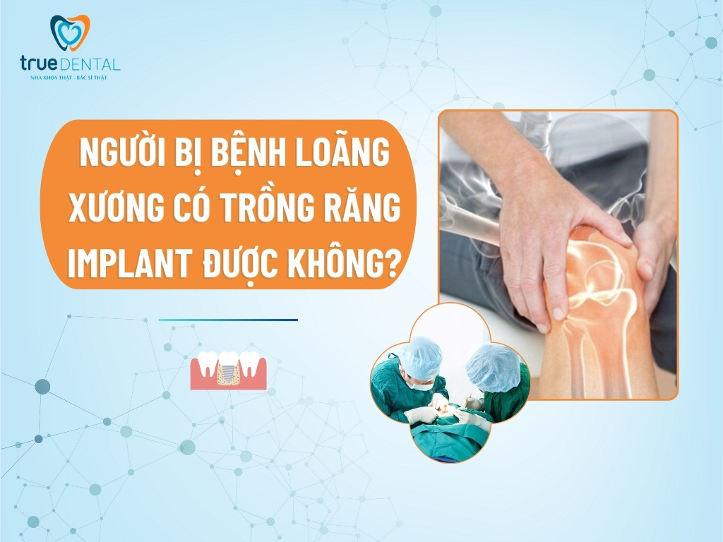 [GIẢI ĐÁP] NGƯỜI BỊ BỆNH LOÃNG XƯƠNG CÓ TRỒNG RĂNG IMPLANT ĐƯỢC KHÔNG?