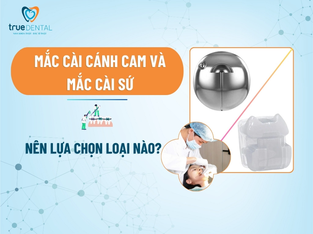 MẮC CÀI CÁNH CAM VÀ MẮC CÀI SỨ: NÊN LỰA CHỌN LOẠI NÀO?