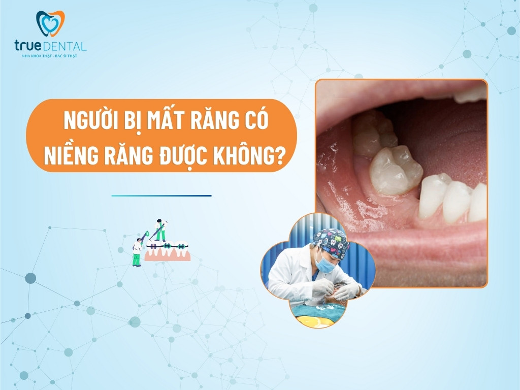 [GIẢI ĐÁP] NGƯỜI BỊ MẤT RĂNG CÓ NIỀNG RĂNG ĐƯỢC KHÔNG?