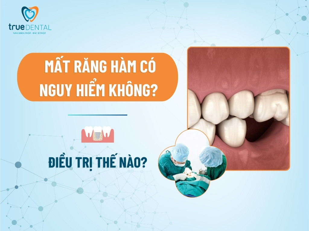 [GIẢI ĐÁP] MẤT RĂNG HÀM CÓ NGUY HIỂM KHÔNG? ĐIỀU TRỊ THẾ NÀO?