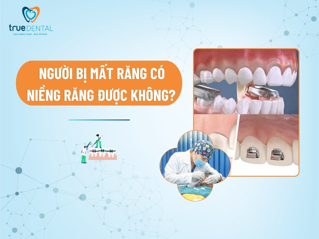 NÂNG HÀM KHI NIỀNG RĂNG CÓ TÁC DỤNG GÌ? CÓ ĐAU KHÔNG?