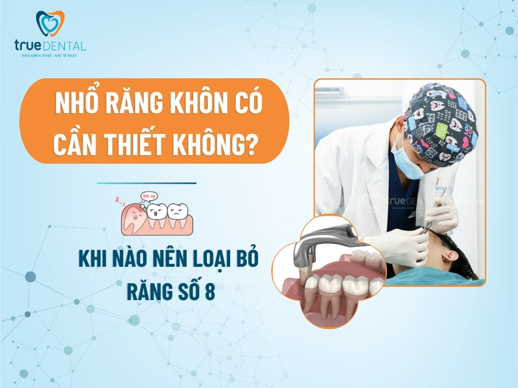 NHỔ RĂNG KHÔN CÓ CẦN THIẾT KHÔNG? KHI NÀO NÊN LOẠI BỎ RĂNG SỐ 8
