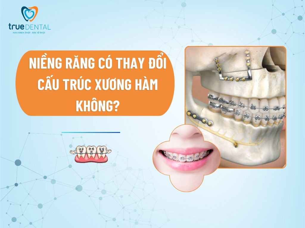 [GIẢI ĐÁP] NIỀNG RĂNG CÓ THAY ĐỔI CẤU TRÚC XƯƠNG HÀM KHÔNG?