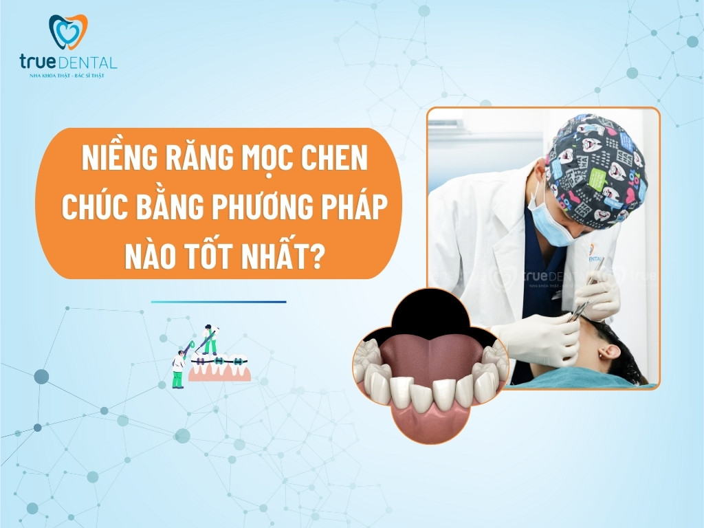 NIỀNG RĂNG MỌC CHEN CHÚC BẰNG PHƯƠNG PHÁP NÀO TỐT NHẤT?