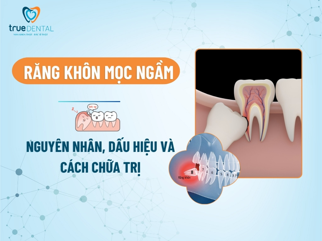 RĂNG KHÔN MỌC NGẦM: NGUYÊN NHÂN, DẤU HIỆU NHẬN BIẾT VÀ CÁCH CHỮA TRỊ