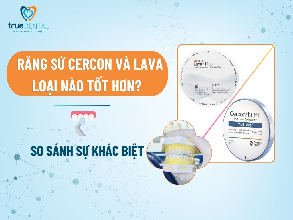 RĂNG SỨ CERCON VÀ LAVA LOẠI NÀO TỐT HƠN? SO SÁNH SỰ KHÁC BIỆT