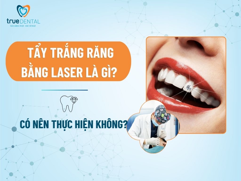 [GIẢI ĐÁP] RĂNG SỨ CÓ ĐÍNH ĐÁ ĐƯỢC KHÔNG?