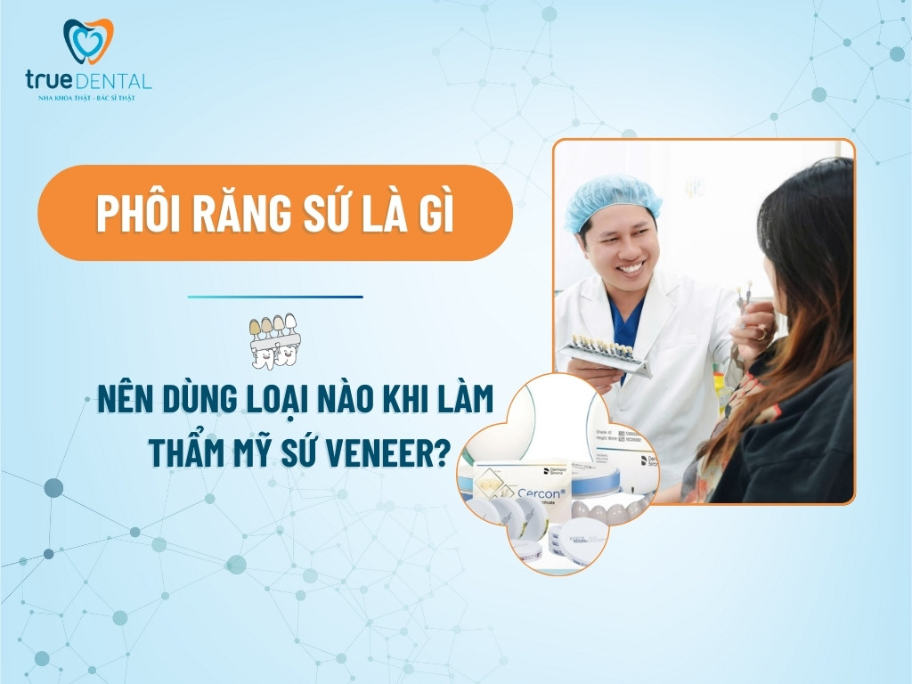 SO SÁNH RĂNG SỨ ZIRCONIA VÀ CERCON: NÊN CHỌN LOẠI NÀO?