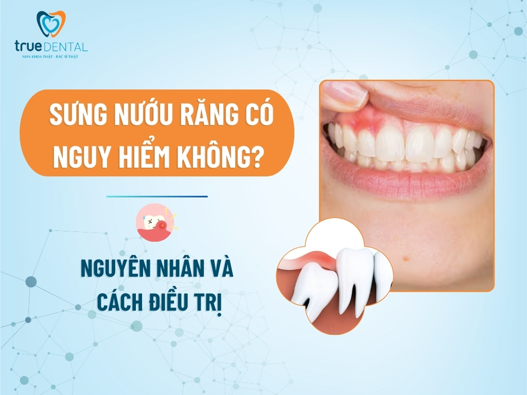 SƯNG NƯỚU RĂNG CÓ NGUY HIỂM KHÔNG? NGUYÊN NHÂN VÀ CÁCH ĐIỀU TRỊ