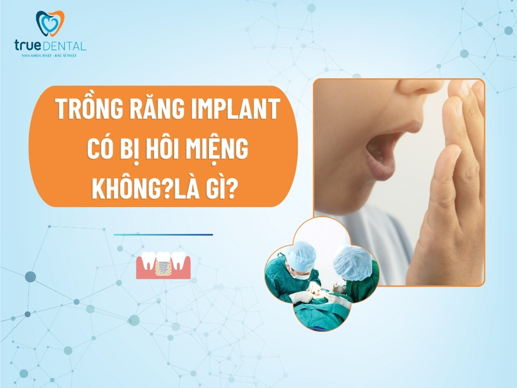 [GIẢI ĐÁP] TRỒNG RĂNG IMPLANT CÓ BỊ HÔI MIỆNG KHÔNG?