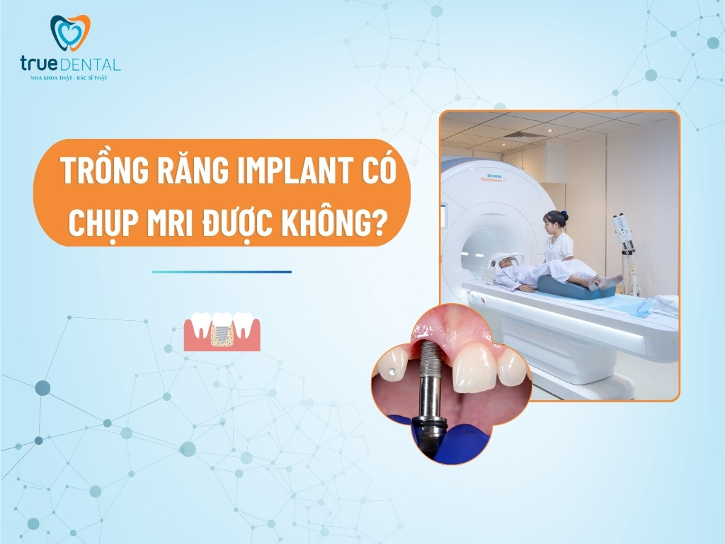 [GIẢI ĐÁP] TRỒNG RĂNG IMPLANT CÓ CHỤP MRI ĐƯỢC KHÔNG?