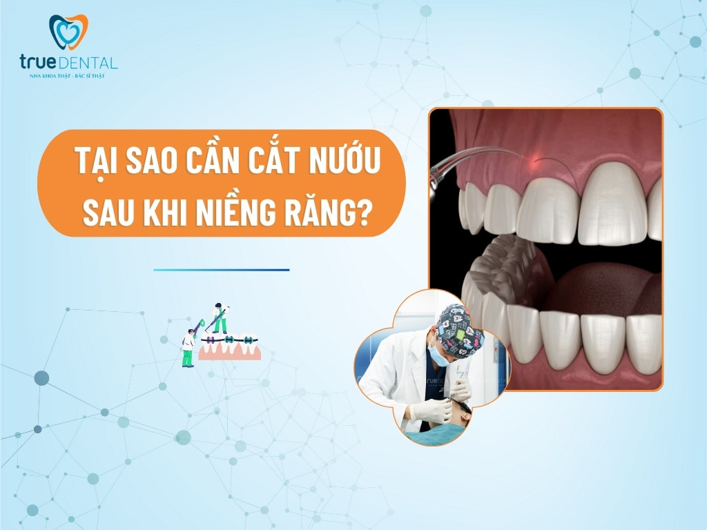 [GIẢI ĐÁP] TẠI SAO CẦN CẮT NƯỚU SAU KHI NIỀNG RĂNG?