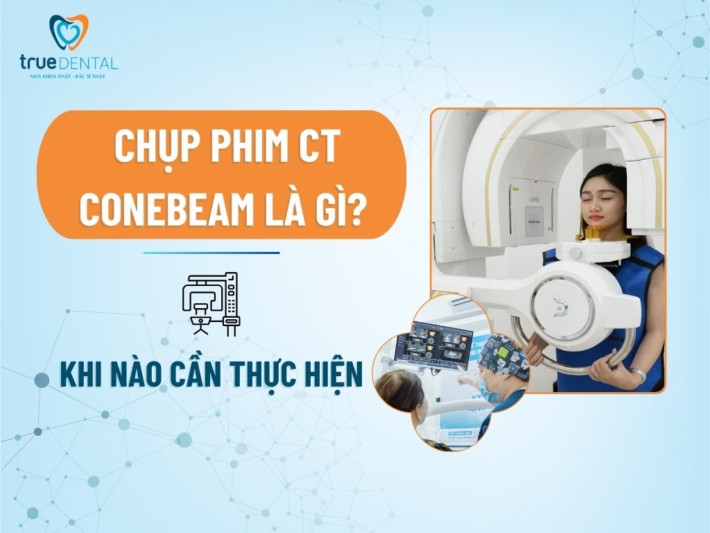 CHỤP PHIM CT CONEBEAM LÀ GÌ? KHI NÀO CẦN THỰC HIỆN