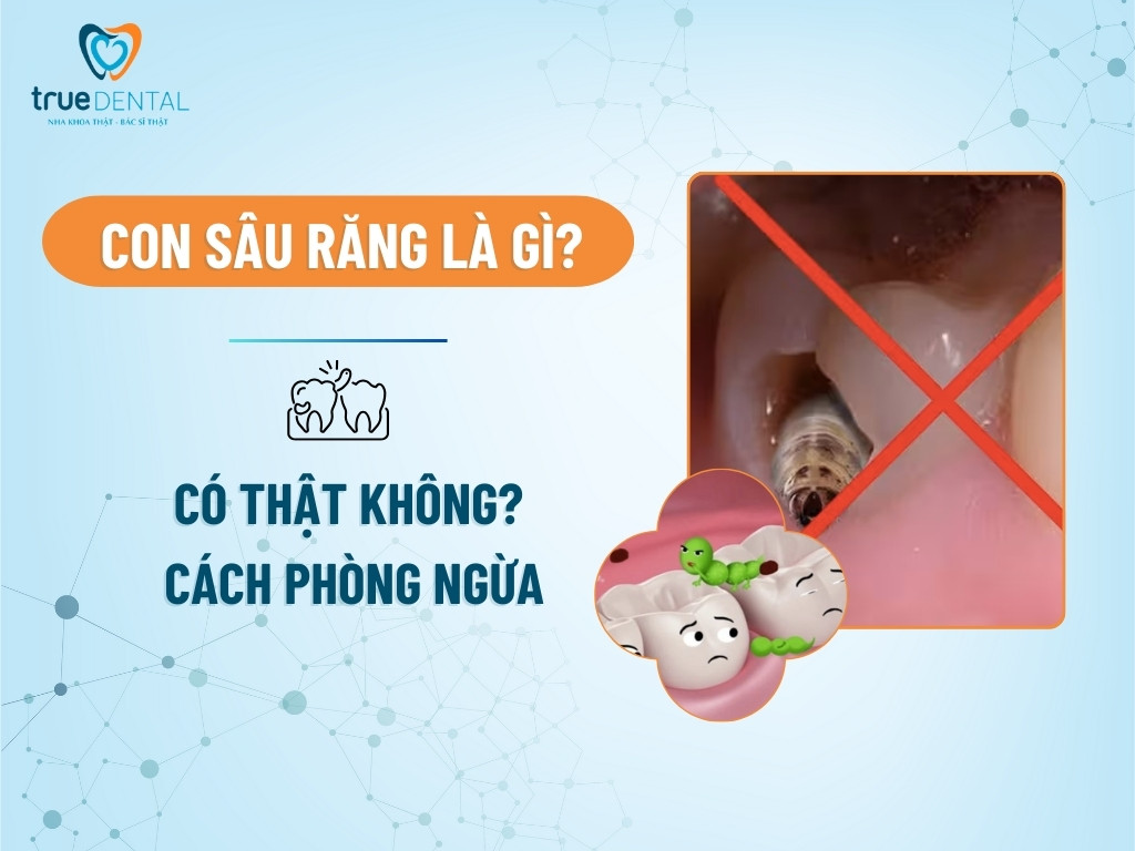 Con sâu răng là gì? Có thật không? Cách phòng ngừa 8 Con sâu răng là gì? Có thật không? Cách phòng ngừa