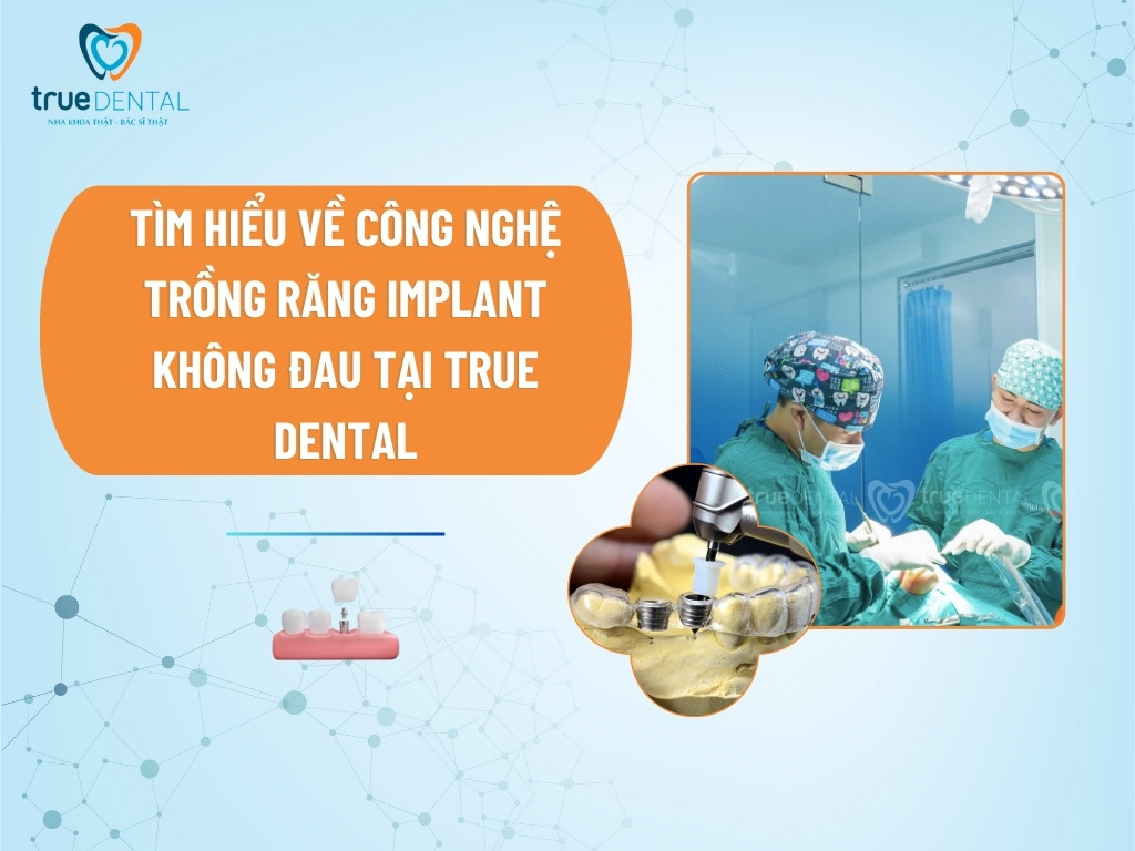TÌM HIỂU VỀ CÔNG NGHỆ TRỒNG RĂNG IMPLANT KHÔNG ĐAU TẠI TRUE DENTAL