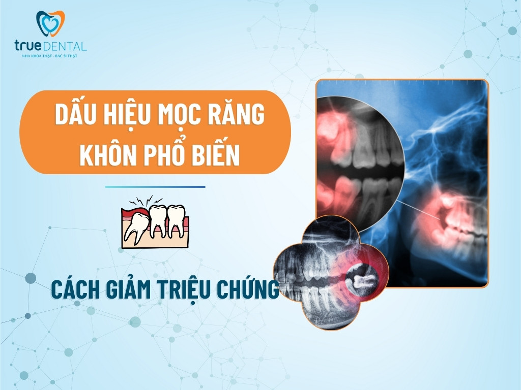 Dấu hiệu mọc răng khôn phổ biến, cách giảm triệu chứng 10 Dấu hiệu mọc răng khôn phổ biến, cách giảm triệu chứng