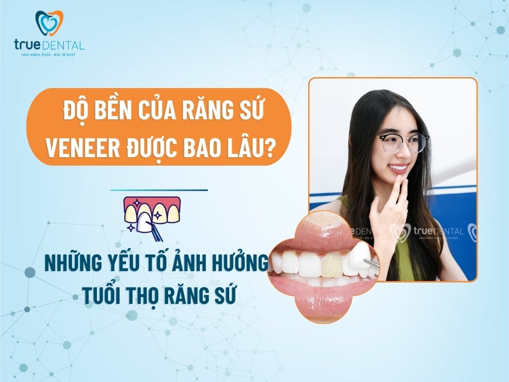 ĐỘ BỀN CỦA RĂNG SỨ VENEER ĐƯỢC BAO LÂU? NHỮNG YẾU TỐ ẢNH HƯỞNG TUỔI THỌ RĂNG SỨ