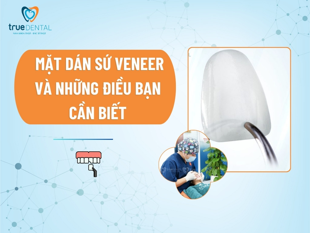 MẶT DÁN SỨ VENEER VÀ NHỮNG ĐIỀU BẠN CẦN BIẾT