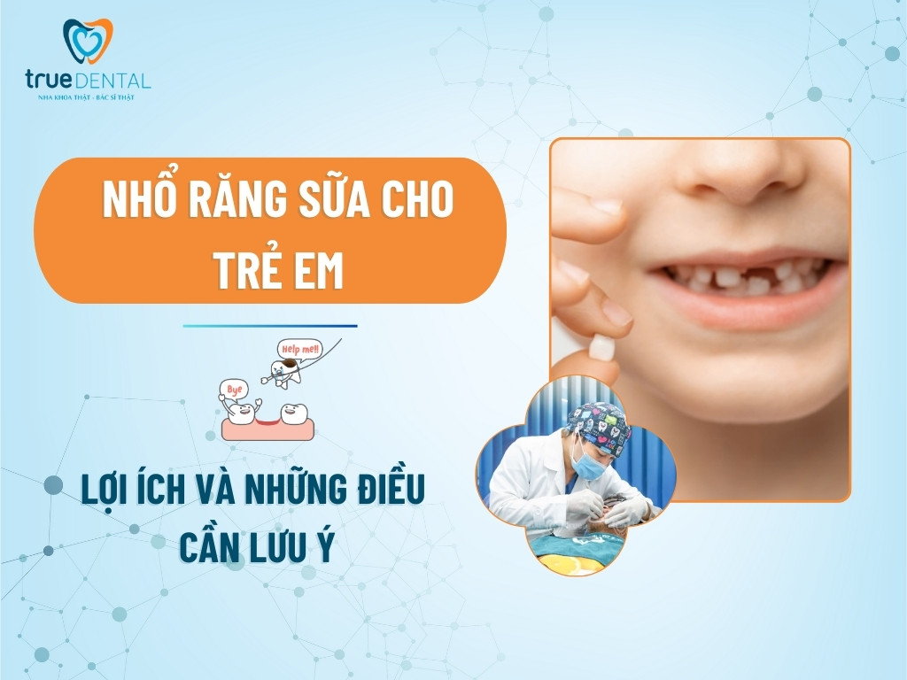 NHỔ RĂNG SỮA CHO TRẺ EM: LỢI ÍCH VÀ NHỮNG ĐIỀU CẦN LƯU Ý