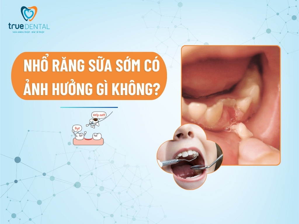 [GIẢI ĐÁP] NHỔ RĂNG SỮA SỚM CÓ ẢNH HƯỞNG GÌ KHÔNG?