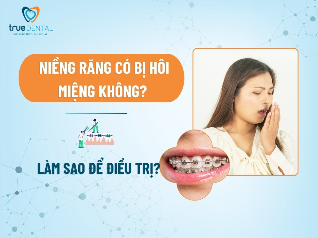 NIỀNG RĂNG CÓ BỊ HÔI MIỆNG KHÔNG? LÀM SAO ĐỂ ĐIỀU TRỊ?