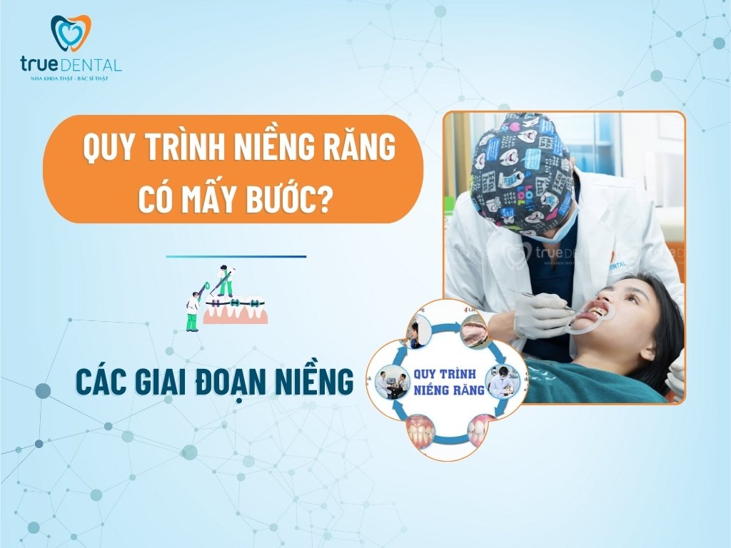 quy trinh nieng rang 1
