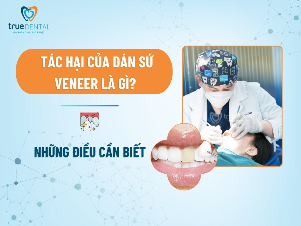 [GIẢI ĐÁP] TÁC HẠI CỦA DÁN SỨ VENEER LÀ GÌ? NHỮNG ĐIỀU CẦN BIẾT