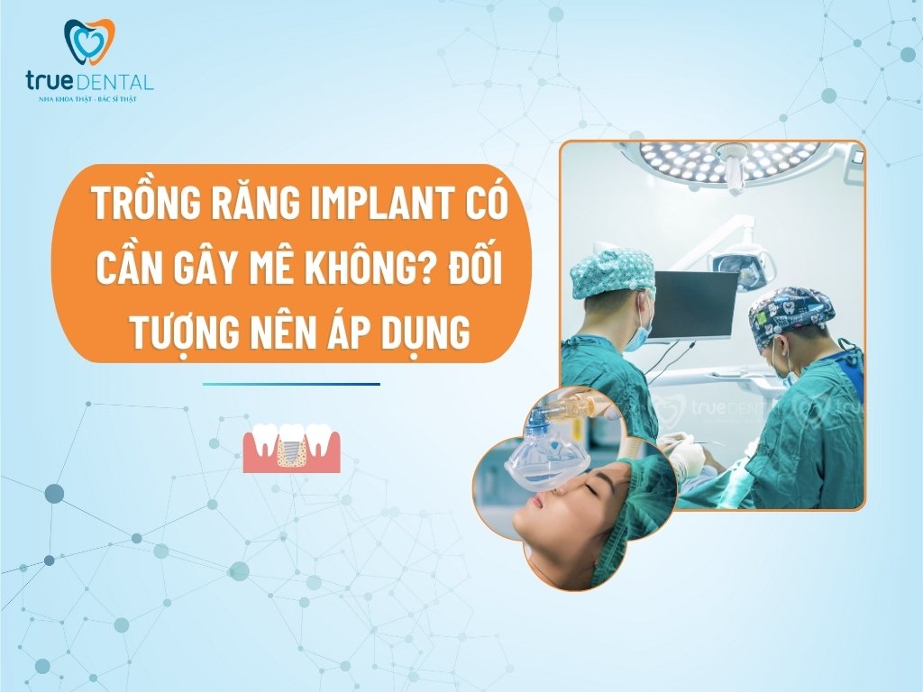 [GIẢI ĐÁP] TRỒNG RĂNG IMPLANT CÓ CẦN GÂY MÊ KHÔNG? ĐỐI TƯỢNG NÊN ÁP DỤNG