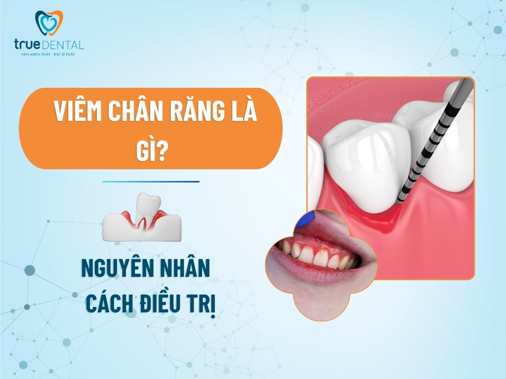 viem chan rang la gi 1
