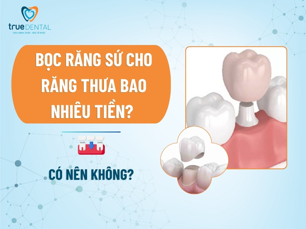 boc rang su cho rang thua bao nhieu tien 1