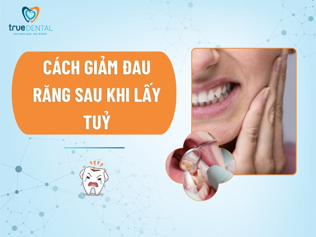 cách giảm đau răng sau khi lấy tuỷ