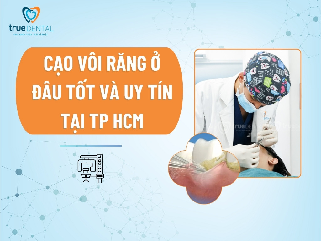 Cạo vôi răng ở đâu tốt và uy tín tại TP HCM 3 Cạo vôi răng ở đâu tốt và uy tín tại TP HCM